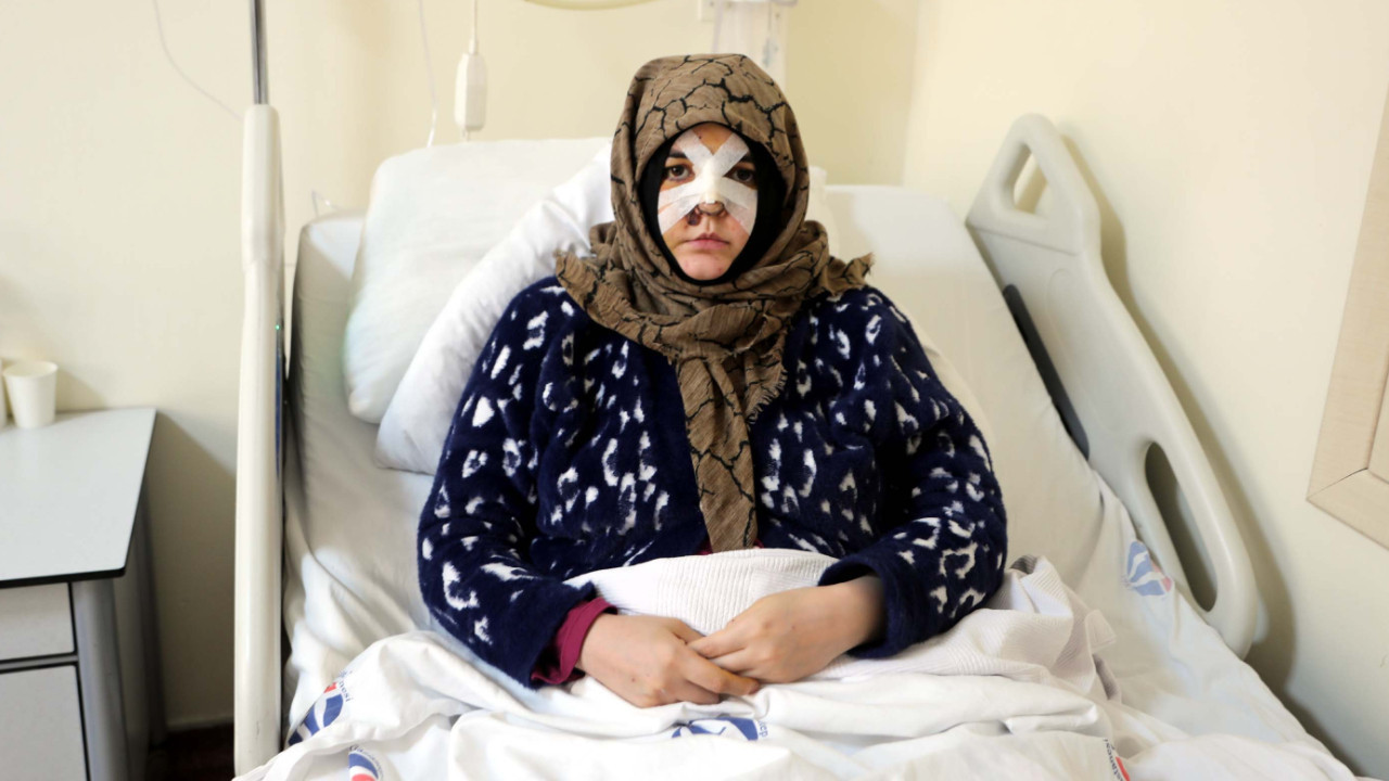 Eşinin kaldırım taşı ile dövdüğü Nazlı: Çıkarsa yarım bıraktığı işi tamamlar