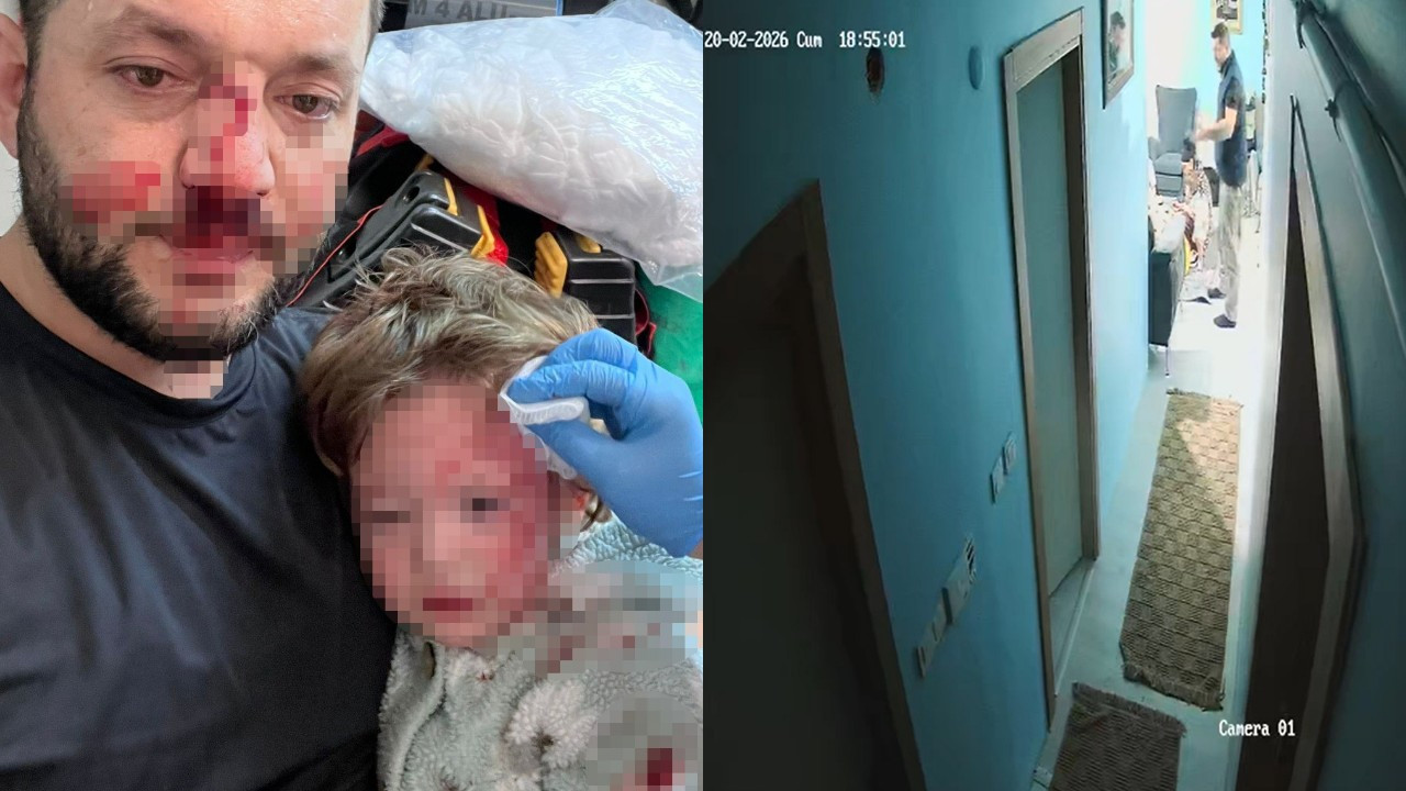 Yalova'da 14 aylık bebeğin yaralandığı komşu kavgası güvenlik kamerasına yansıdı