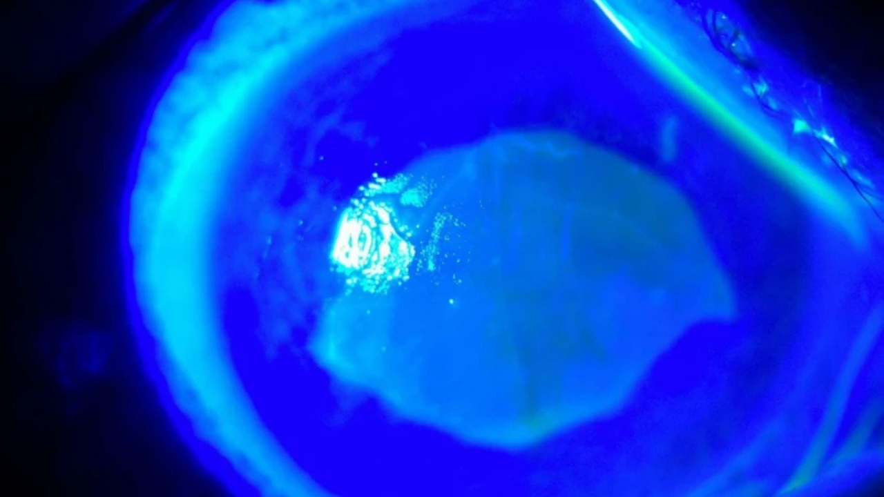 Kör eden ot! "Gözlerine suyunu damlattı, göremez hale geldi" Uzmanlar uyardı: Önermiyoruz!