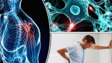 Küçük yaşlarda yaşanan uyku problemleri ileriki yaşlarda MS hastalığını yüzde 50 artırıyor!