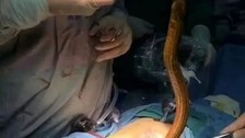 Polonya'da kabızlık çeken bir adama tüyler ürperten tedavi yöntemi uygulandı! "Anüsünden yılan balığı..."