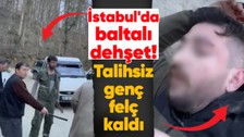 İstanbul'da baltalı dehşet! Kafasına vurulan genç felç kaldı! O anlar kamerada