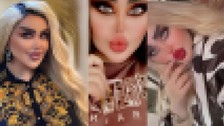 Bağdatlı Dalia Naeem Barbie'ye benzemek için tam 43 kez estetik operasyon geçirdi! Son hali görenleri korkuttu