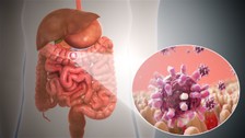 Gastroenterit enfeksiyon nedir, belirtileri neler?