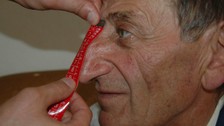 Dünyanın en uzun burunlu adamı Mehmet Özyürek hayatını kaybetti