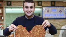 CZN Burak hastaneye kaldırıldı
