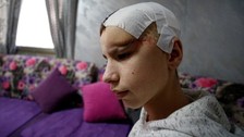 İsrail askerinin açtığı ateşte yaralanan Abürrahman el-Zagıl "yarım kafatasıyla" yaşamını sürdürüyor