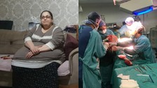 Düştüğünde kalkamayan 130 kilo ağırlığındaki kadının vücudundan 25 kilo yağ çıktı