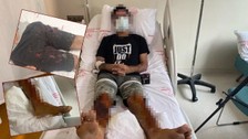 Temizlik yapayım derken canından olacaktı! Lavaboya döktüğü açıcı bomba gibi patladı