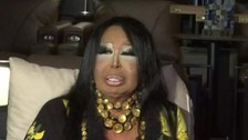 Diva korkuttu! Bülent Ersoy sahnede fenalaştı