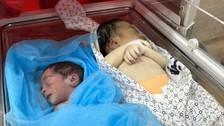 Ramazan'ın ilk gününde 2 bebek daha açlıktan öldü