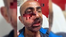 Hakkari'de tarlasına gitti iki ayının saldırısına uğradı