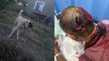 Bahçede Kangal saldırısı! Başından ısırılan adama 100 dikiş atıldı