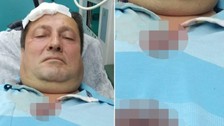 Evinin balkonunda otururken başına yorgun mermi isabet etti