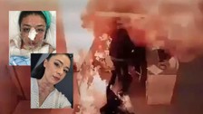 Hastanede alev alev yanan Gizem Hemşire dehşet gününü anlattı: Yakayım mı sizi
