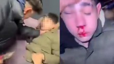 Dilsiz ve sağır çocuğa işkence! O anları kayda alıp abisine gönderdiler