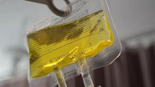 Çok sayıda can kaybı oldu! Bakanlıktan 'sarı serum' açıklaması