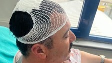 Belediye Başkan Yardımcısı’nı şekerlikle başına vurarak yaraladı