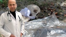 Çöpten kafatası çıktı! Uzman doktorun eşi atmış: Dikkat çeken 1994 detayı