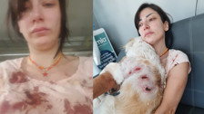 Bursa'da kangal dehşeti: Hem genç kıza hem de köpeğine saldırdılar! O anlar kamerada