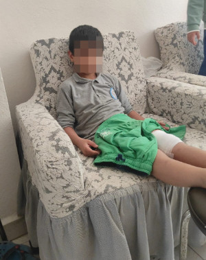 Okula giderken sokak köpeğinin saldırısına uğradı