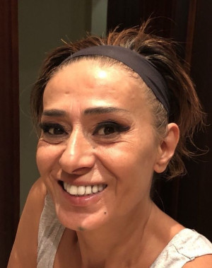 Yıldız Tilbe hayranlarını korkuttu