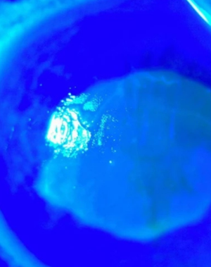 Kör eden ot! "Gözlerine suyunu damlattı, göremez hale geldi" Uzmanlar uyardı: Önermiyoruz!