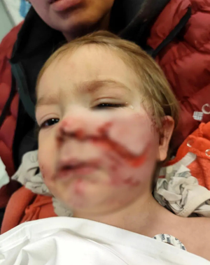 Ankara’da pitbull dehşeti! 1,5 ve 5 yaşındaki çocuklar yaralandı, sahibi yakalandı - Resim: 4