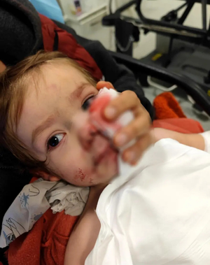 Ankara’da pitbull dehşeti! 1,5 ve 5 yaşındaki çocuklar yaralandı, sahibi yakalandı - Resim: 2