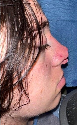 Ameliyattan sonra hayatı değişti! Burnundan saç çıkan kadını gören dönüp bir daha bakıyor! - Resim: 17