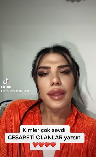 Fenomen isim Mükremin, yaptırdığı estetik operasyonla dillere düştü - Resim: 9