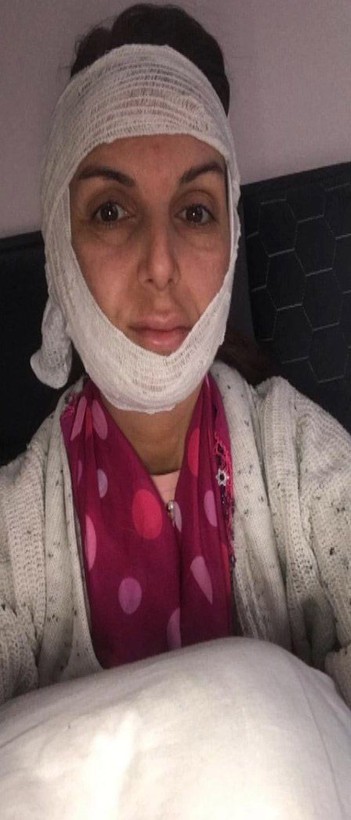 Topuklu sesi yüzünden çalışanını öldüresiye dövdü - Resim: 2