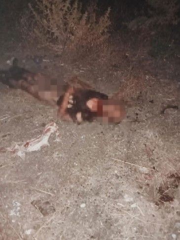 Fatih'te sokak köpeklerinin parçalayarak öldürdüğü adam neler yaşadı? Vahşet hastane raporunda - Resim: 5