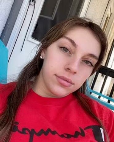 Ameliyattan sonra hayatı değişti! Burnundan saç çıkan kadını gören dönüp bir daha bakıyor! - Resim: 16
