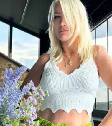 'Ben çorap kadınıyım' sözleriyle damga vuran Seda Sayan son dönemin popüler sünnet derisi operasyonunu yaptırdı! - Resim: 4