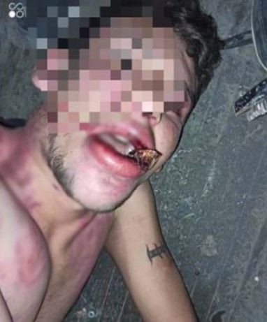 Antalya'da kan donduran olay! Maaşını istedi diye dişlerini kerpetenle söküp böcek yedirdiler - Resim: 9