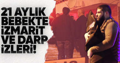 Denizli'de ölü olarak bulunan 21 aylık Murat Aslan bebeğin vücudunda darp ve izmarit izlerine rastlandı