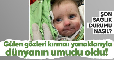 Gülen gözleri kırmızı yanaklarıyla dünyanın umudu oldu! Mucize bebek mucize kurtuluşuyla şoke etti! Son sağlık durumu ne?