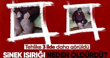 Bacaklarını fil gibi yapan sinek ısırığı neden öldürdü? 'Türkiye'de 3 ilde görülüyor'