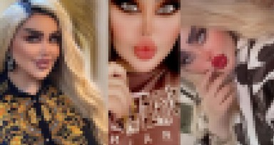 Bağdatlı Dalia Naeem Barbie'ye benzemek için tam 43 kez estetik operasyon geçirdi! Son hali görenleri korkuttu