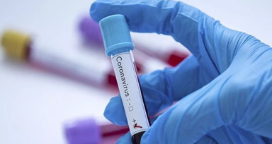 Koronavirüs kabusu yeniden mi hortluyor? Profesörden kritik uyarı: Çok hızlı seyreden ve ölüme neden olan bir tablo olarak görülmeye başladı