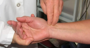 Ev hanımlarında sık görülen Karpal Tünel Sendromu tedavi edilmezse kalıcı hasar bırakabiliyor | Nedir Karpal Tünel Sendromu?