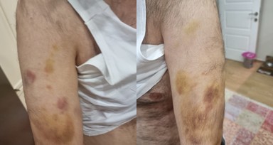 Spor okulu öğretmeni otizmli öğrenciyi darp edip boğazını sıktı