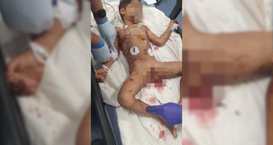 Sokak köpeklerinin saldırısına uğrayan çocuk ağır yaralandı