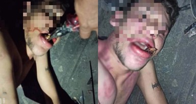 Antalya'da kan donduran olay! Maaşını istedi diye dişlerini kerpetenle söküp böcek yedirdiler