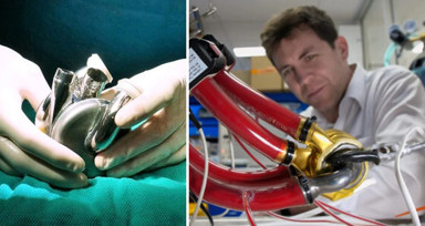 Tıpta çığır açacak gelişme: İlk mekanik yapay kalp başarıyla nakledildi