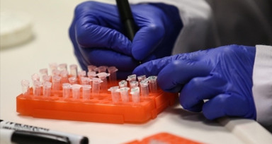 Dünya Sağlık Örgütü ilk M çiçeği aşısını ön yeterlilik alan aşı listesine ekledi