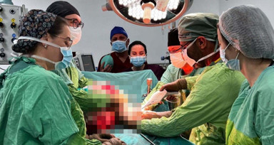 'Karın ağrısı' şikayetiyle gittiği hastanede karnından 26 kiloluk tümör çıktı