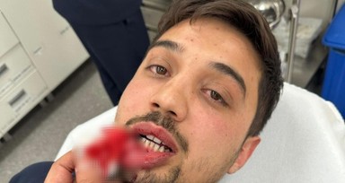 Tekstilci iş insanı ile oğlundan hasta taşıyan ambulans şoförüne saldırı