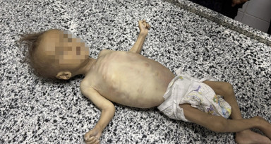 Gazze'de Selam Ebu Vadi açlıktan öldü